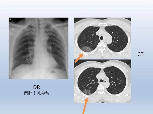 肺炎冠狀病毒最新動(dòng)態(tài)及應(yīng)對(duì)策略綜述